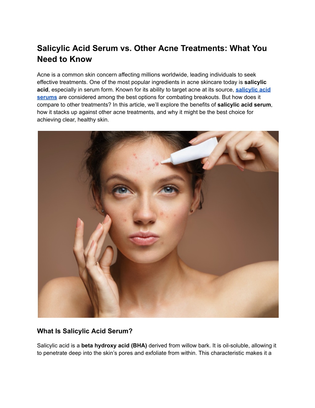 salicylic acid serum vs other acne treatments l.w