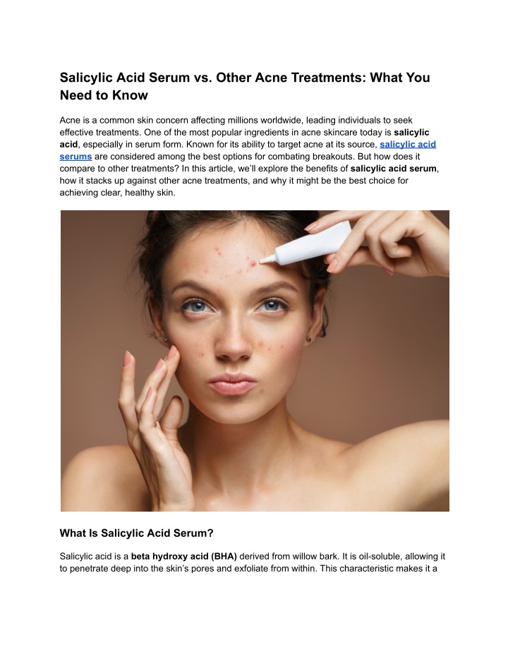 salicylic acid serum vs other acne treatments n.w