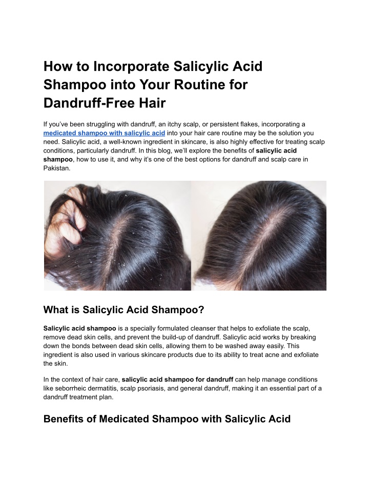 how to incorporate salicylic acid shampoo into n.w
