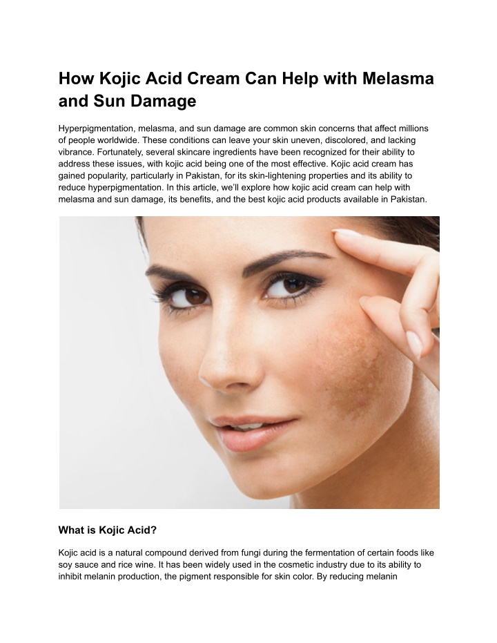 how kojic acid cream can help with melasma n.w