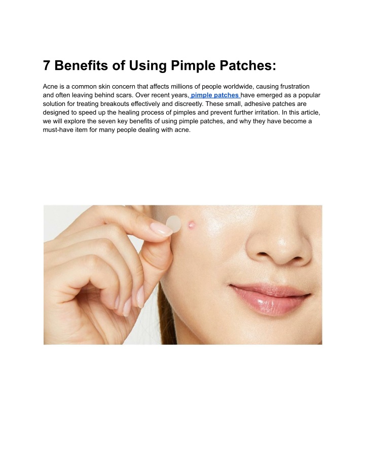 7 benefits of using pimple patches n.w