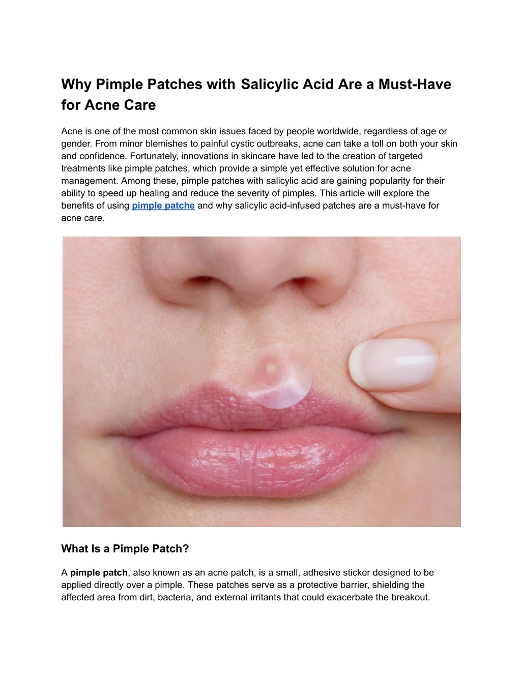 why pimple patches with salicylic acid are a must l.w