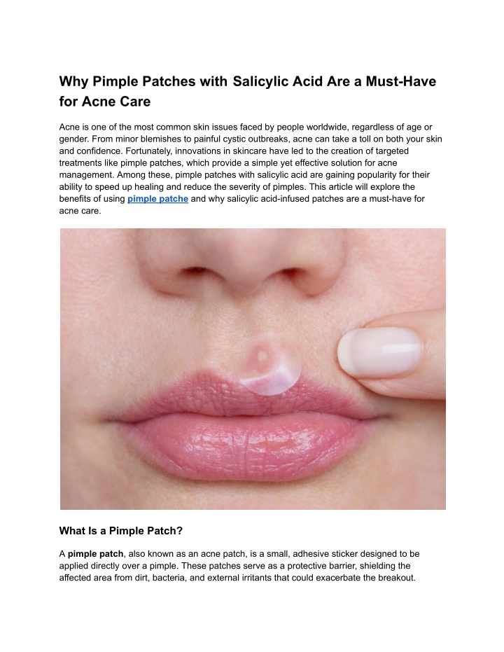 why pimple patches with salicylic acid are a must n.w