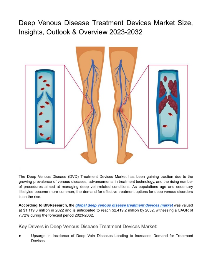 deep venous disease treatment devices market size n.w