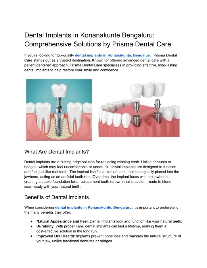 dental implants in konanakunte bengaluru n.w