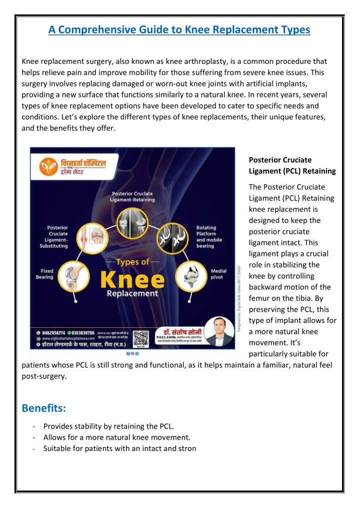 a comprehensive guide to knee replacement types n.w