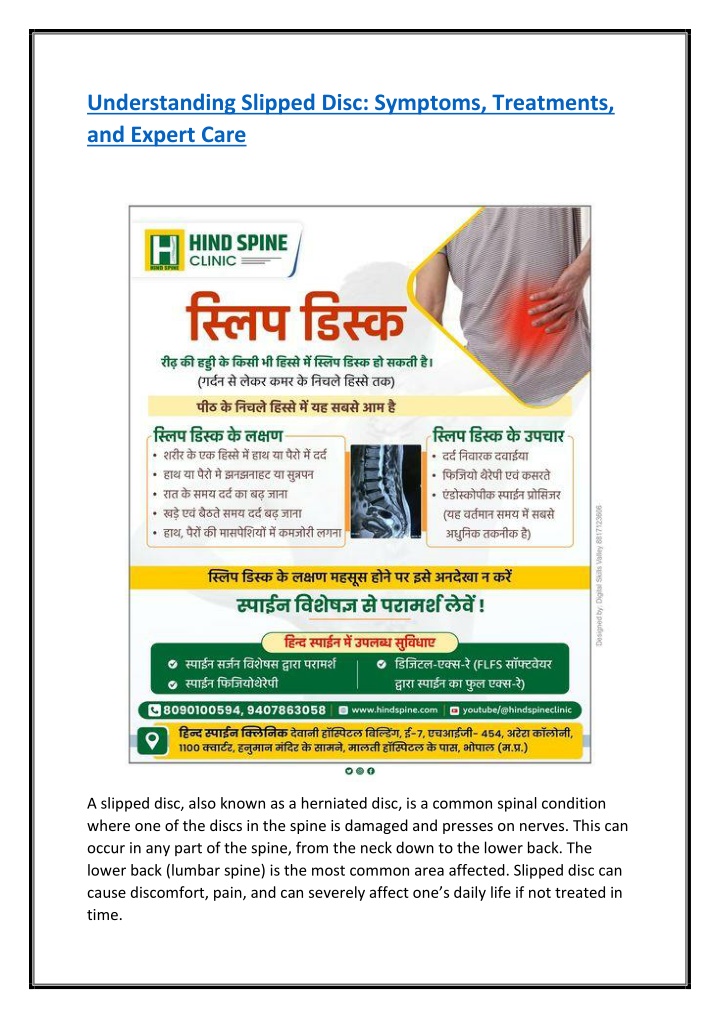 understanding slipped disc symptoms treatments n.w