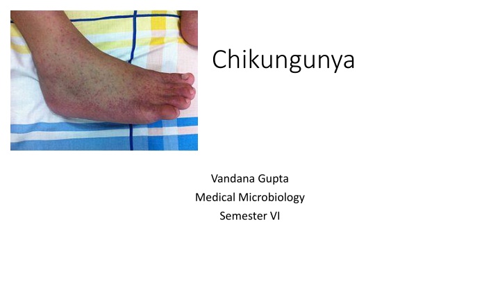 Chikungunya Virus: Symptoms, Transmission, and Diagnosis