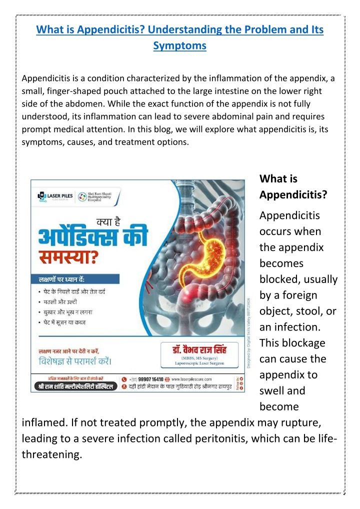 what is appendicitis understanding the problem n.w