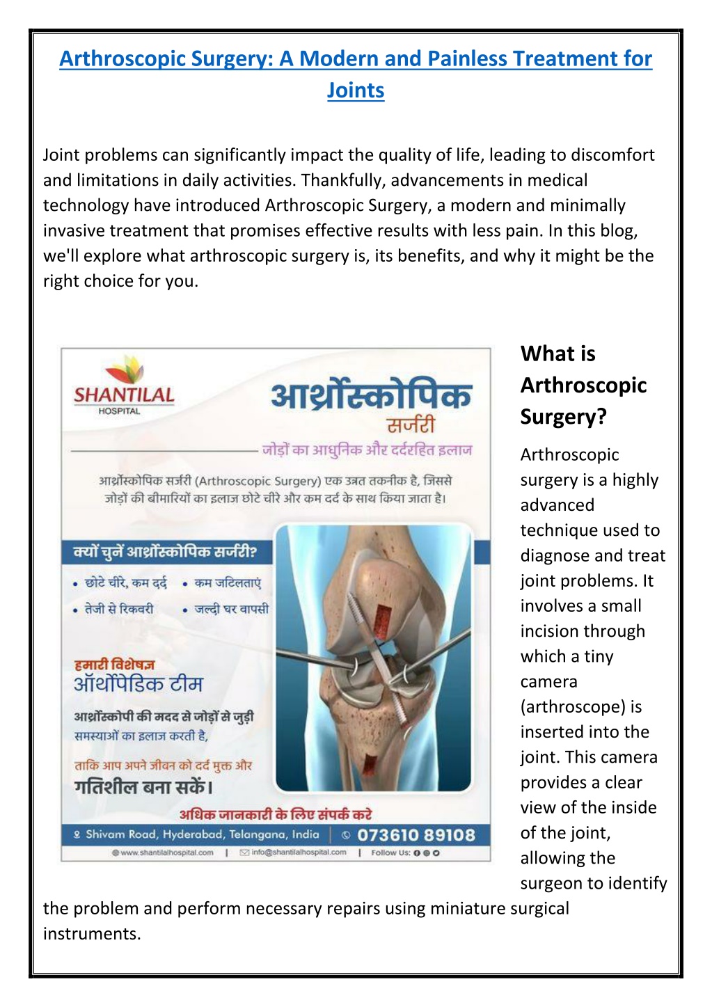 arthroscopic surgery a modern and painless l.w