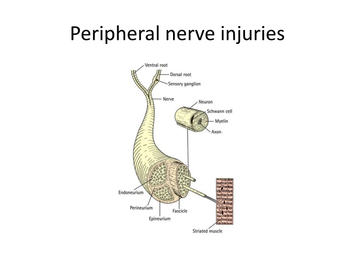 Peripheral Nerve Injuries and Pathological Classification