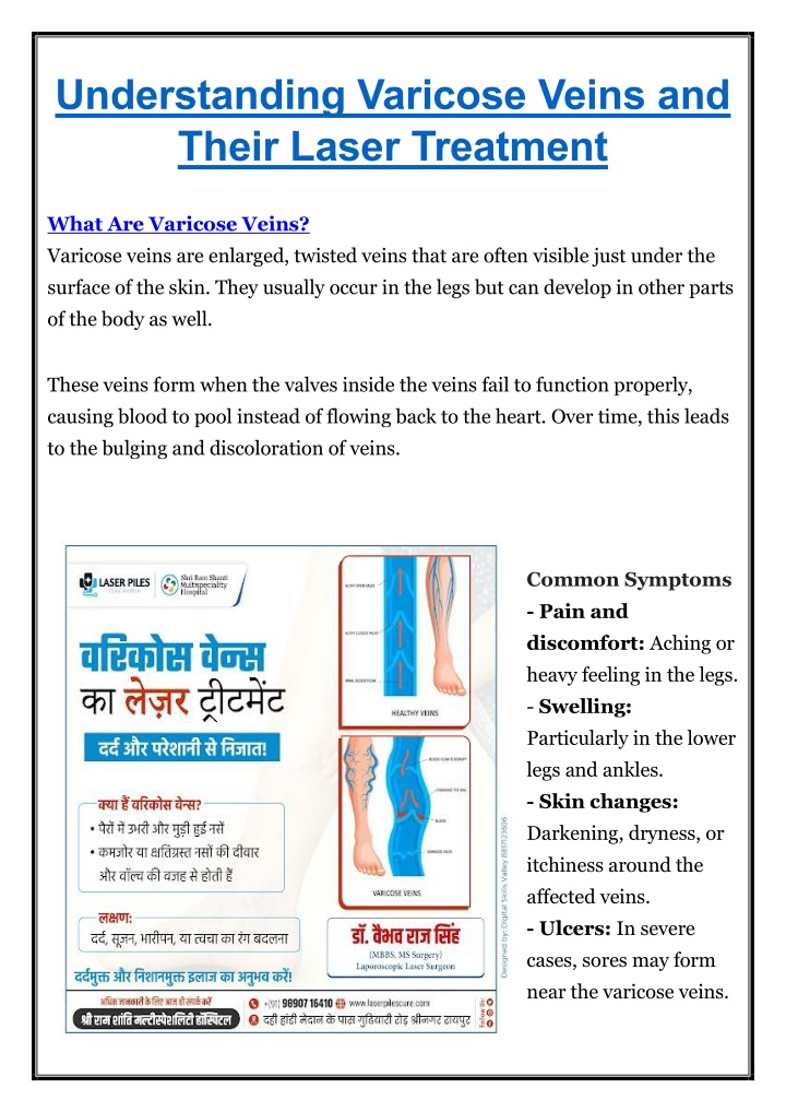 understanding varicose veins and their laser n.w