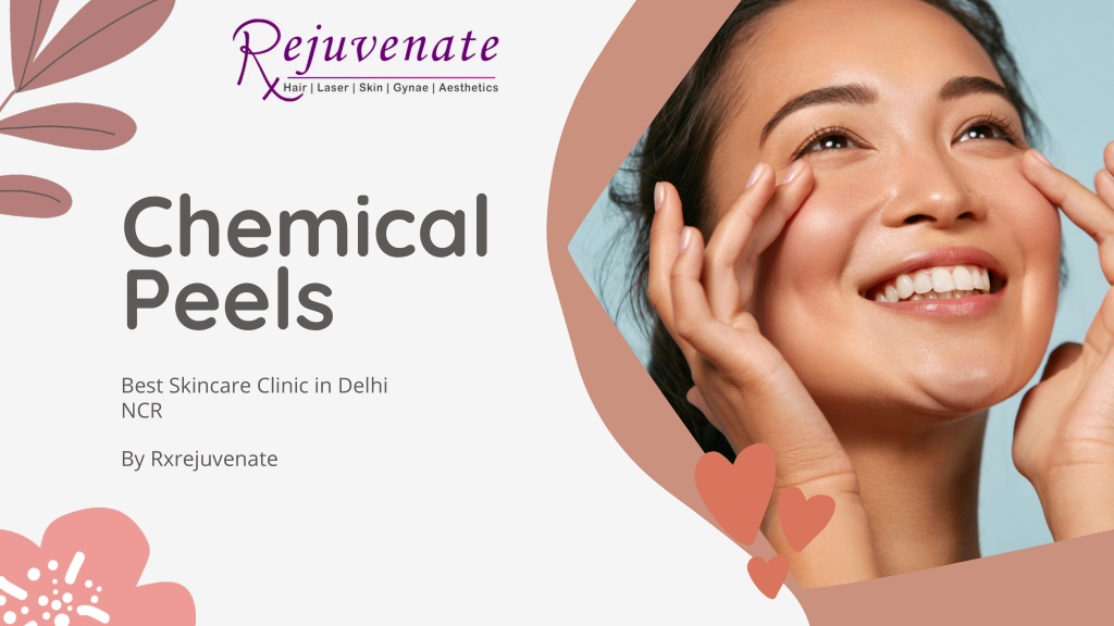 chemical peels l.w