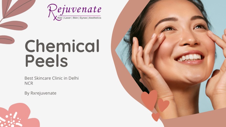 chemical peels n.w
