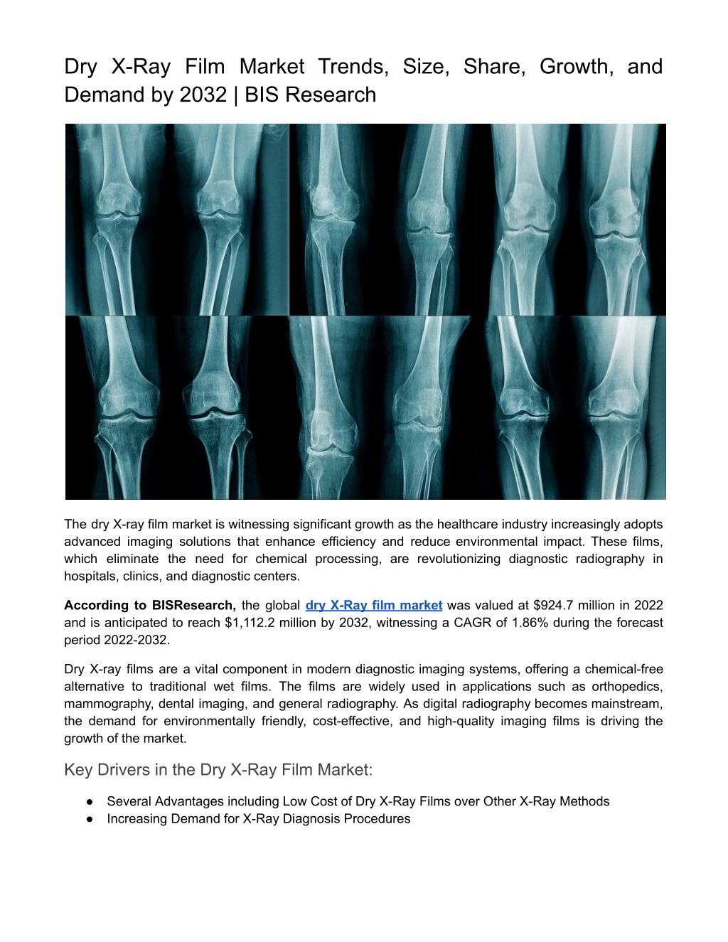 dry x ray film market trends size share growth l.w