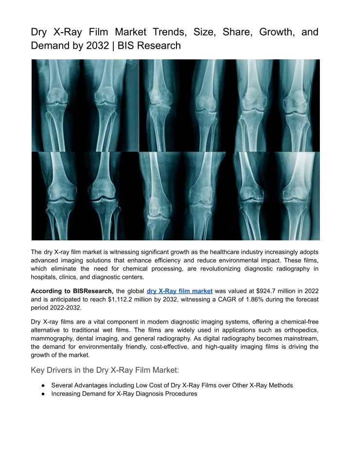 dry x ray film market trends size share growth n.w
