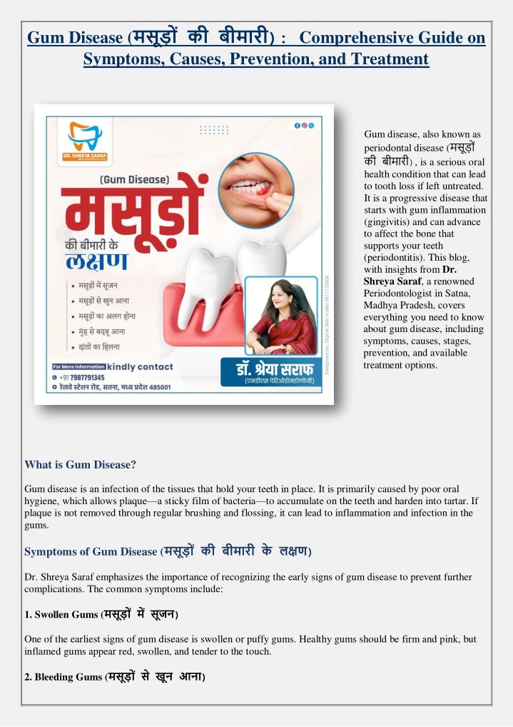 gum disease comprehensive guide on symptoms n.w