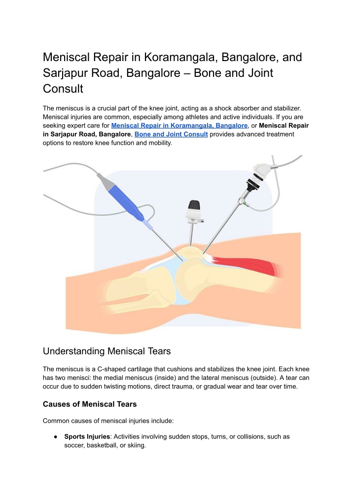 meniscal repair in koramangala bangalore n.w