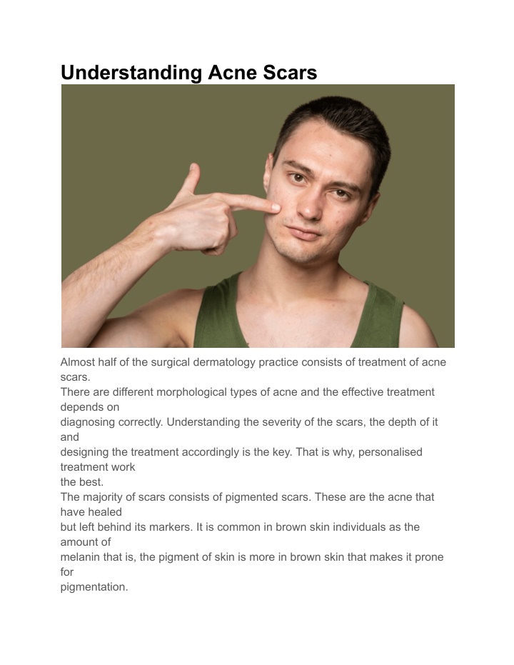 understanding acne scars n.w