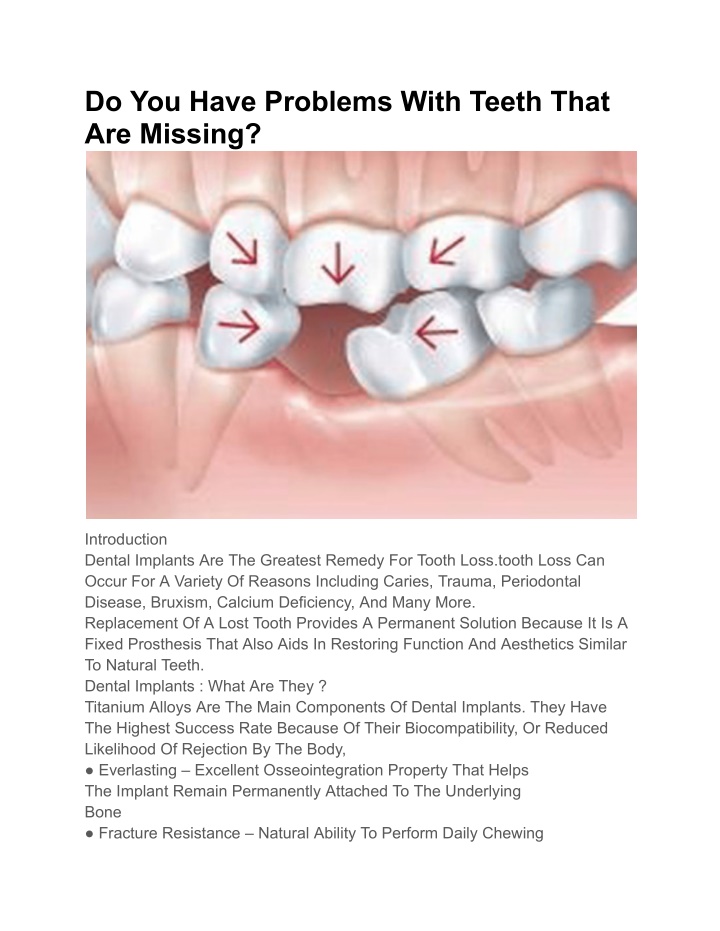 do you have problems with teeth that are missing n.w