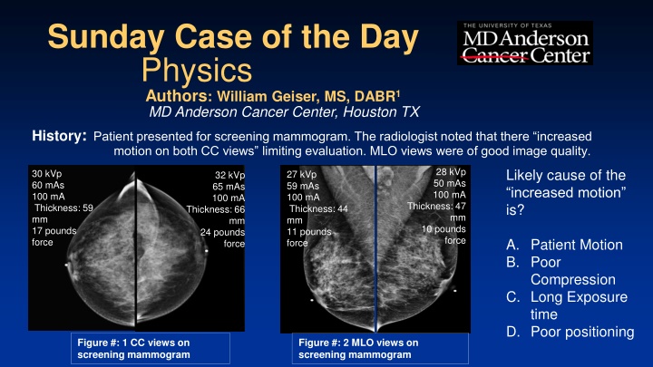 Sunday Case of the Day - Screened Mammogram Findings