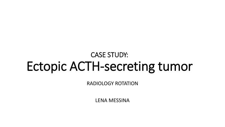 Ectopic ACTH-Secreting Tumor: Radiology Findings
