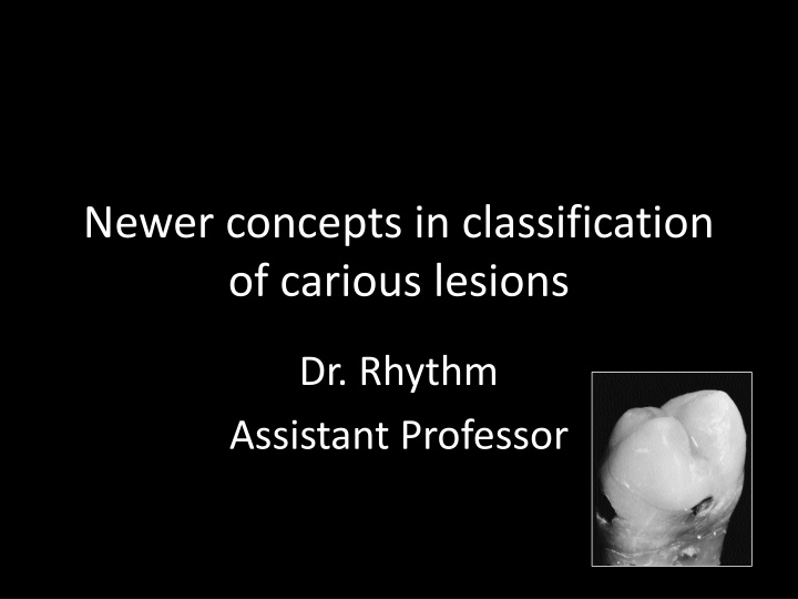 Evolution of Carious Lesion Classification