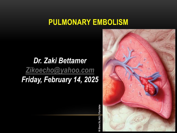 Pulmonary Embolism and Its Risk Factors