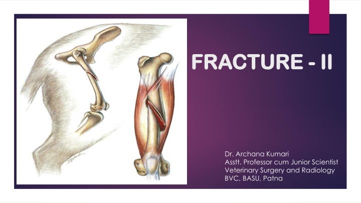 FRACTURE  FRACTURE - - II II