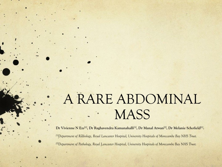 A Rare Abdominal Mass: Clinical Presentation and Diagnosis