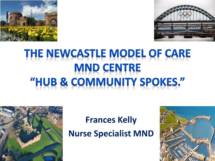 Newcastle Model of Care for MND Patients