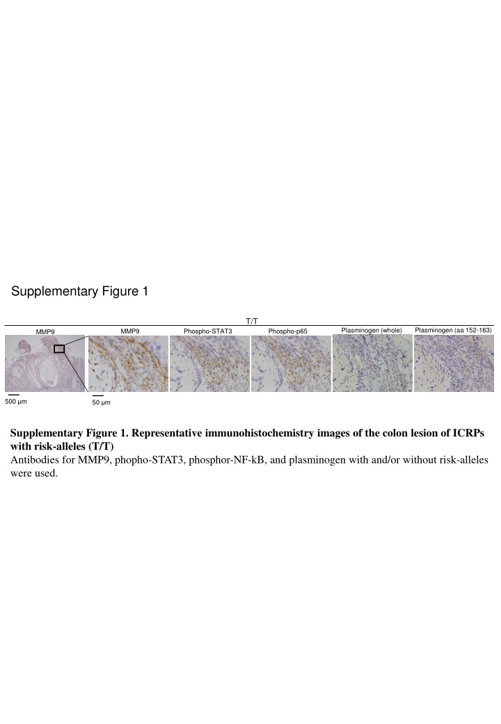 Correlation Analysis on Colon Lesions and Diseases
