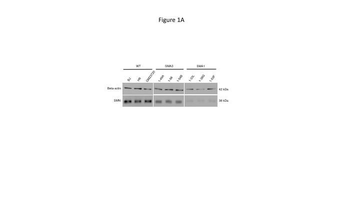 Characterization of WT SMA3 in Beta-actin and SMN Blots