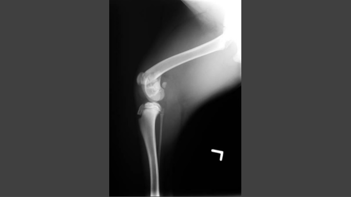 Contrast Radiography: Advantages and Uses