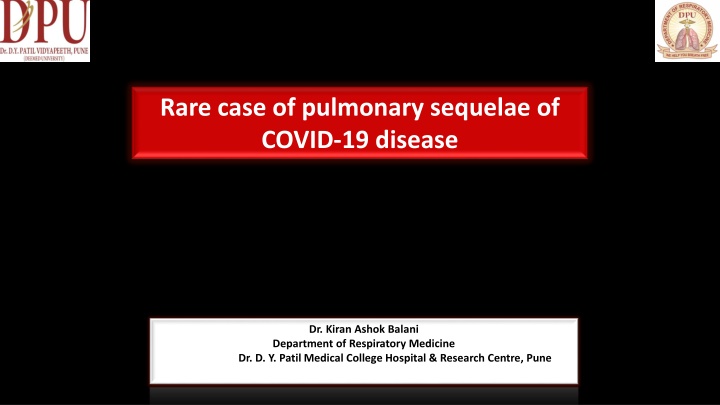 Rare Case of Pulmonary Sequelae of COVID-19 Disease in a 29-Year-Old Male
