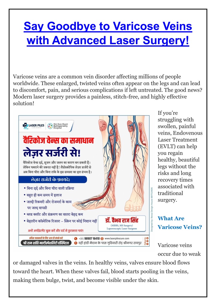say goodbye to varicose veins with advanced laser n.w