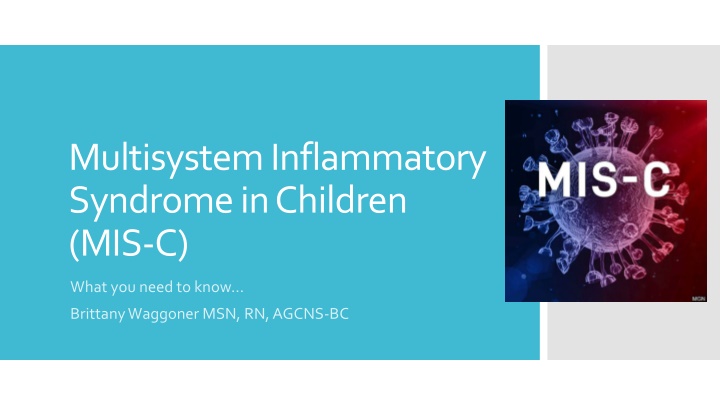 Overview of Multisystem Inflammatory Syndrome in Children