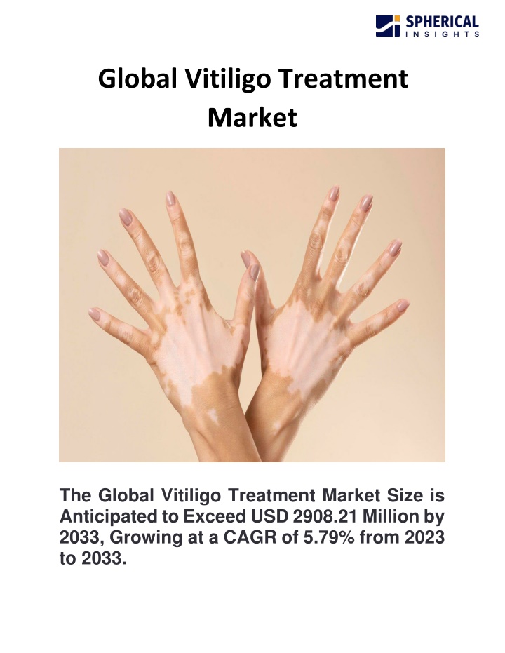 global vitiligo treatment market n.w