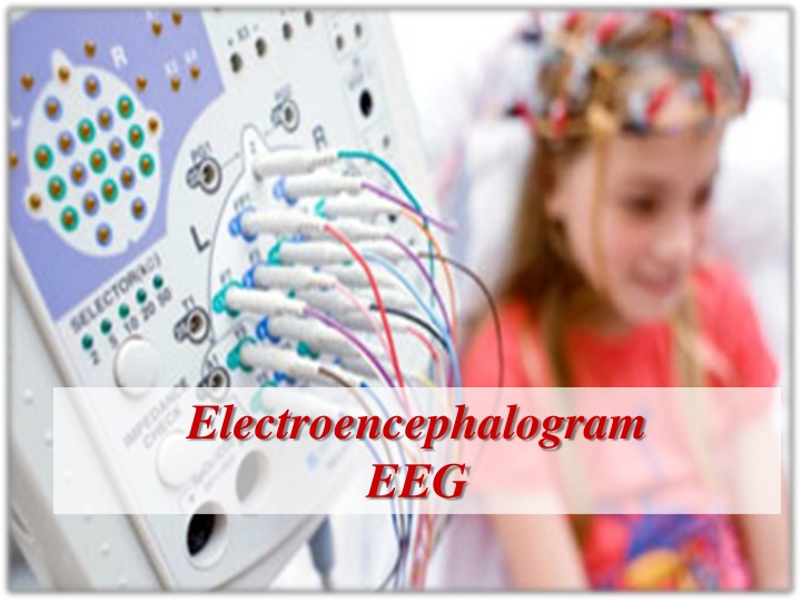 Electroencephalogram