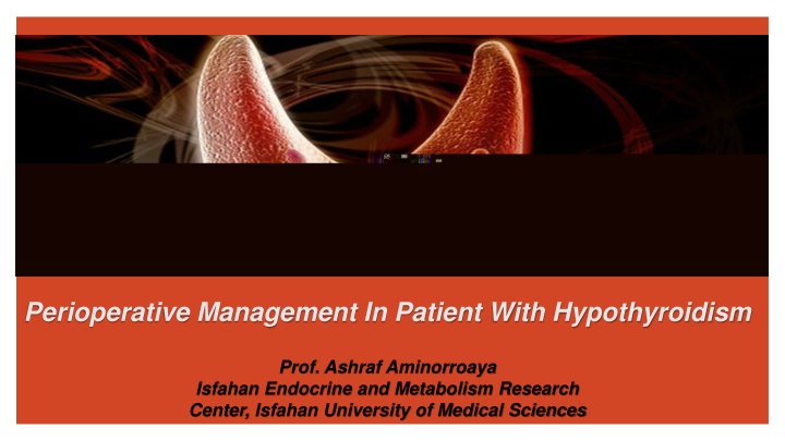 Perioperative Management in Patients with Hypothyroidism