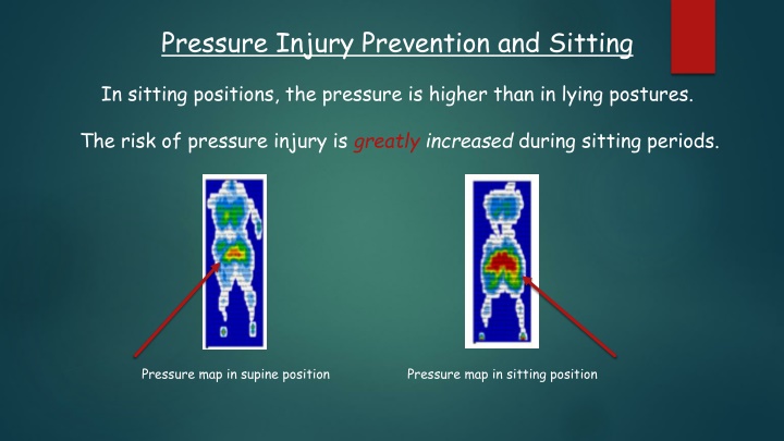 Pressure Injury Prevention and Sitting