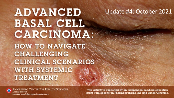 New Insights on Locally Advanced Basal Cell Carcinoma Management