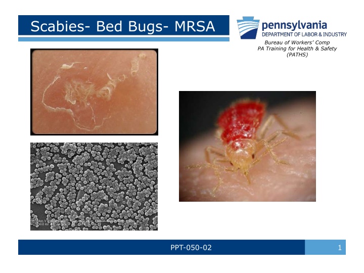 Scabies, Bed Bugs, and MRSA