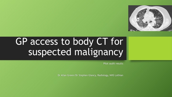 Pilot Audit Results for Suspected Malignancy Imaging Pathway