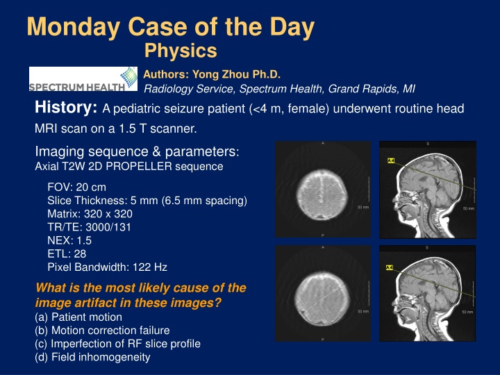 Pediatric Head MRI: Motion Correction Failure