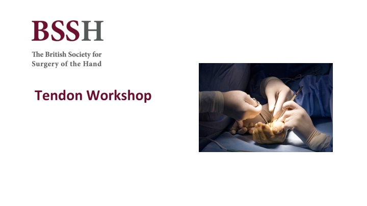 tendon workshop n.w