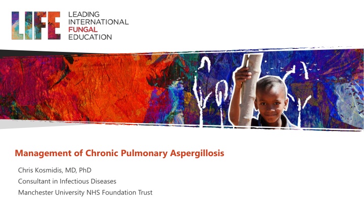 management of chronic pulmonary aspergillosis n.w