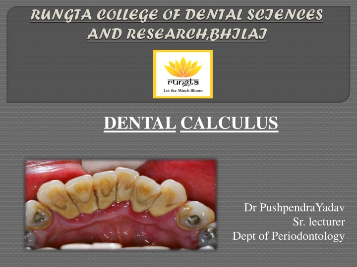dentalcalculus n.w