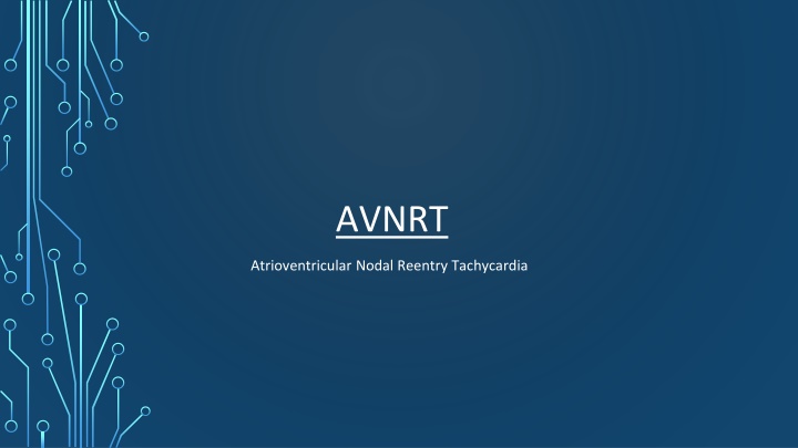 avnrt n.w