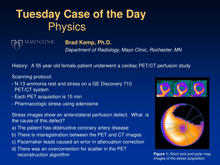 tuesday case of the day physics n.w
